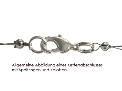 Kettenverschluß mit Spaltringen (allgemeine Abbildung)